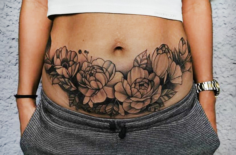Tummy Tuck Tattoo Cover Up  What You Need To Know  Tattoo Shoo